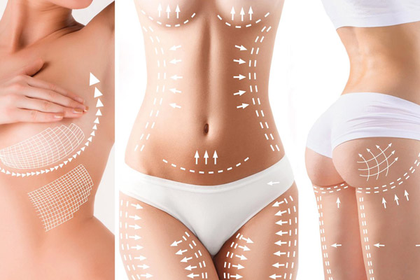 annelik-estetigi-MOMM-MAKEOVER-600x400 Mommy Makeover - Op. Dr. Ertan Günal Gaziantep